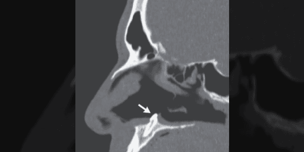 Tıkalı burnu muayene eden doktorlar acil ameliyat kararı aldı! Kimse gördüğüne inanamadı