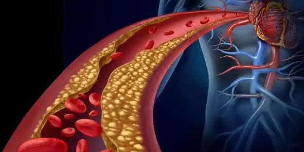 Tıkanan Damarları Açan Besinler