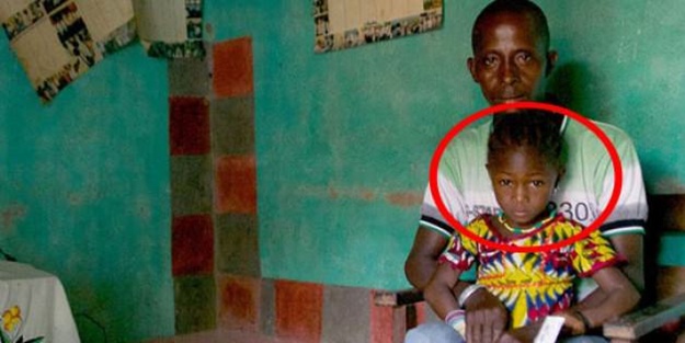 Tıp Dünyası bu iddiayı konuşuyor! Ebola'yı...