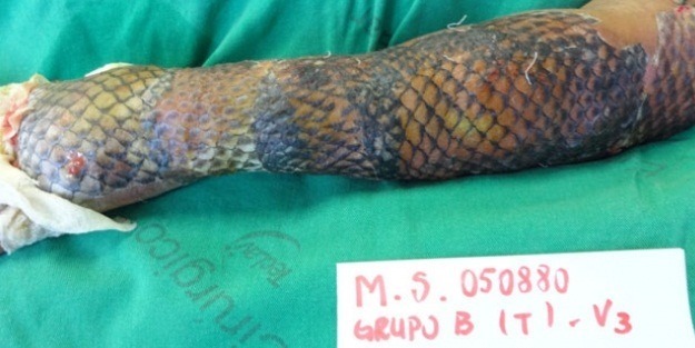 Tıp tarihinde bir ilk