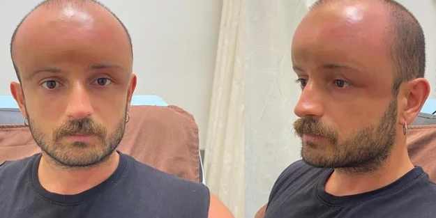 Tıp tarihine geçti doktorlar şaşkın! Zonguldak'ta denize giden adam...