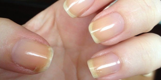 Tırnağınıza diş macunu sürerseniz...