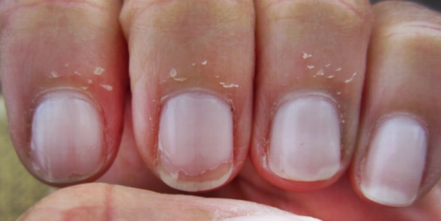 Tırnak etlerinizin soyulmaması için...