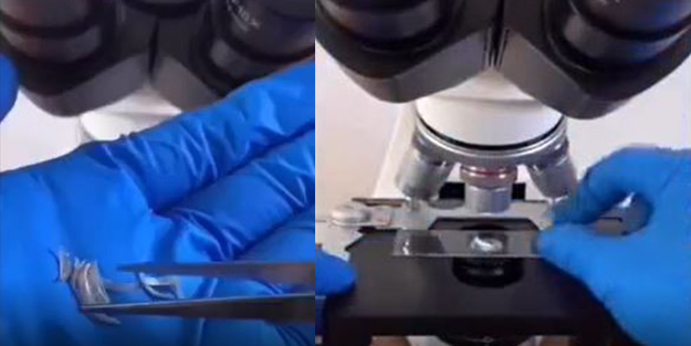 Tırnak yiyenler bir daha elini ağzına götürmeyecek! Mide bulandıran görüntü