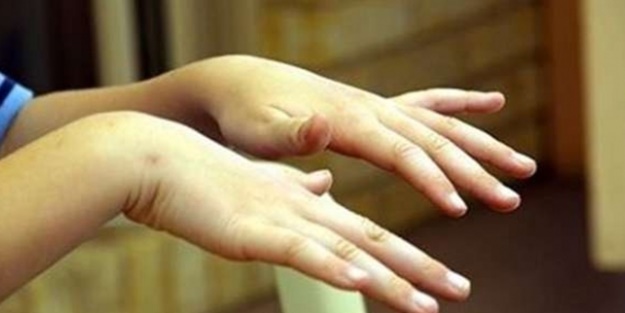 Titreyen eller hastalık habercisi