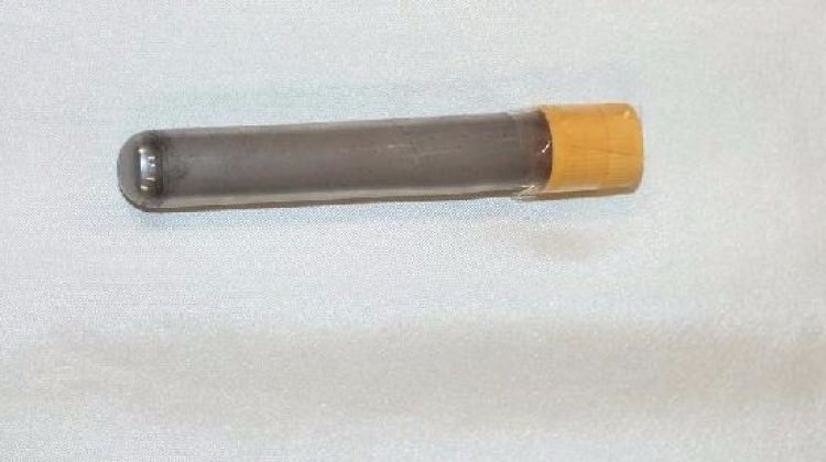 Tokat'ta yakalandı! Çok tehlikeli ve zehirli