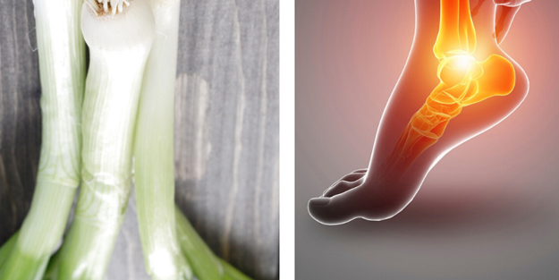 Topuk Dikeni nasıl oluşur ve evde topuk dikeni kürleri: sır gibi doğal yöntemler!