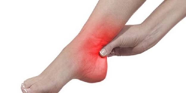 Topuk dikenine karşı denenmiş doğal yöntem