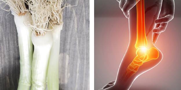 Topuk dikenine ne iyi gelir? Topuk dikenine ev yapımı kür tarifleri