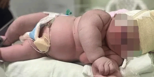 Tosun gibi maşallah! Tam 7 kilo doğdu