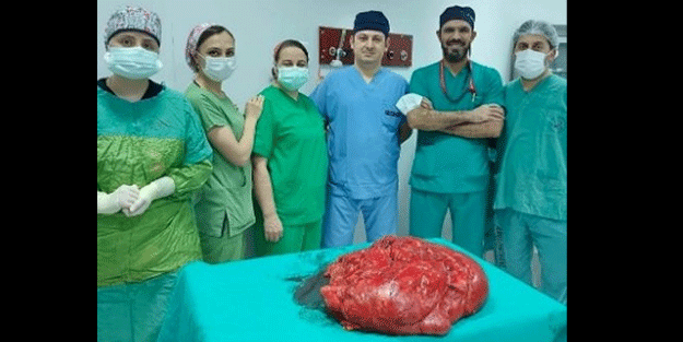 Karnından çıkanlar şok etti! Tam 21 kilogram