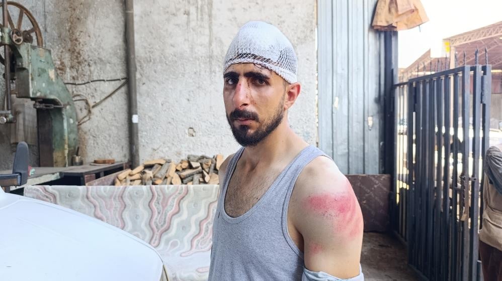 Trafikte yavaş gidiyor diye burnunu kırıp kafasını yardılar