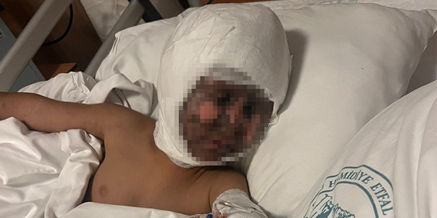 Trafoya çatal soktu...