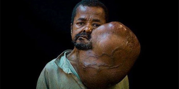 Tuhaf tıp olayları! - FOTO