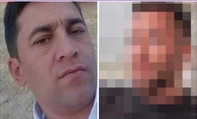 Tüm Türkiye bu olayı konuşuyor! 50 milyon TL'lik vurgun yaptı, estetikle bu hale geldi