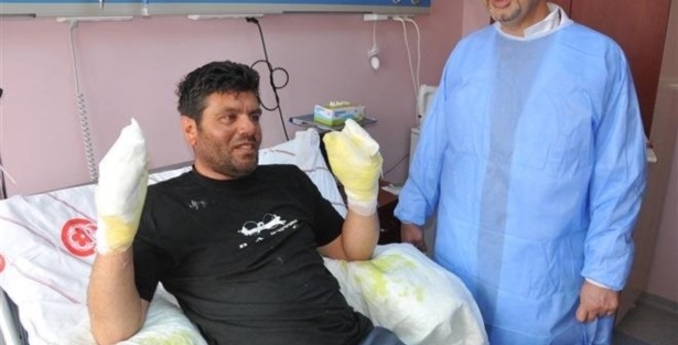 Tüpü çakmakla kontrol etti bakın ne oldu!