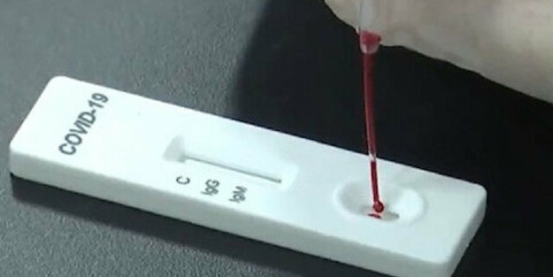 Türk çift 3 dakikada koronavirüs testi yapan kit üretti
