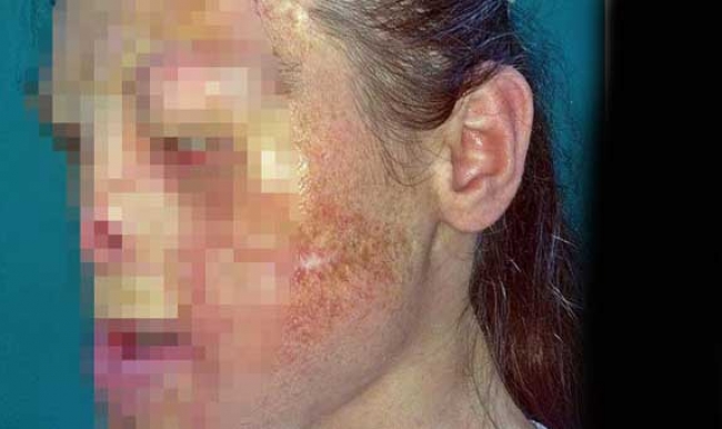 Türk doktor tıp tarihine geçti!