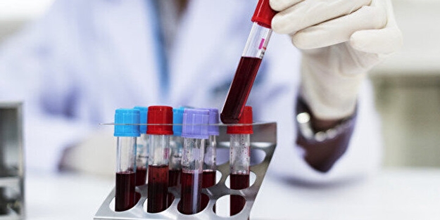 Türk hekimden müthiş buluş! Kan testi artık tarihe karışacak