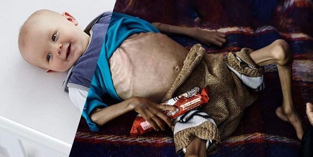 Türk kullanıcıdan dikkat çeken çalışma! Adaletsizliği 'tek kareye' sığdırdı