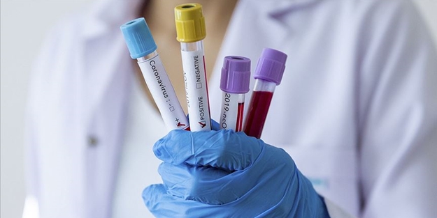 Türk profesörden korkutan koronavirüs çıkışı!