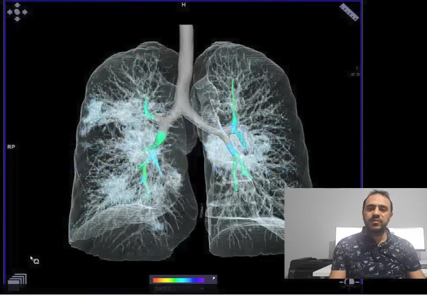 Türk yazılım mühendislerinden “yapay zeka ve derin öğrenme destekli Kovid-19 tanı sistemi” 