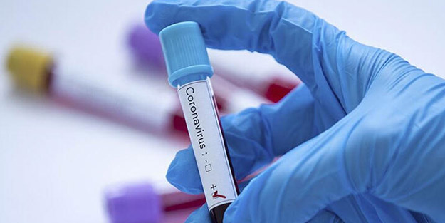 Türkiye çember altında! O Karadeniz ülkesine de koronavirüs sıçradı