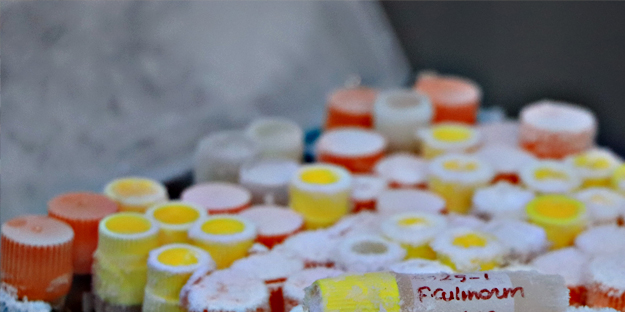 Türkiye için çok önemli bir koleksiyon... Bir bir ve bu kez olacak...