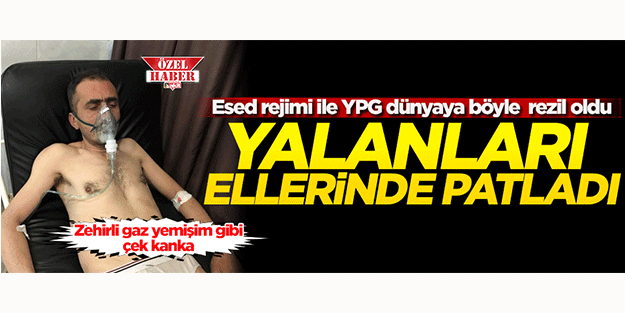 'Türkiye zehirli gaz kullandı' yalanı ellerinde patladı