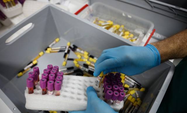 Türkiye'de bir ilk! İstanbul'daki tüm testler tek çatı altında!