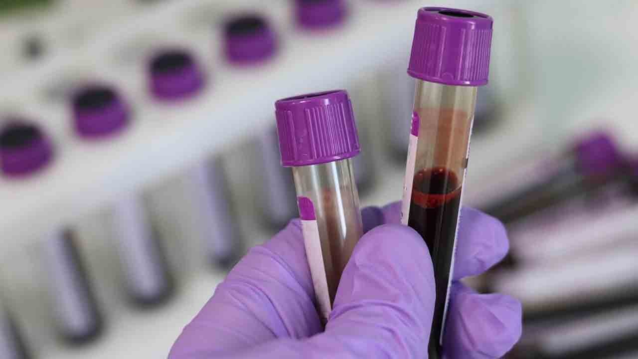 Türkiye'de bir ilk: Kan kanserinde yeni dönem: CAR-T tedavisi Türkiye’de umut verdi