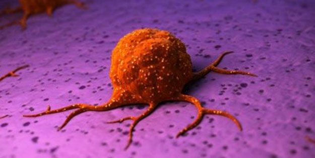 Türkiye'de her sene 10 bin kişide görülüyor! Erken teşhis mümkün! Uzmanı tavsiye etti