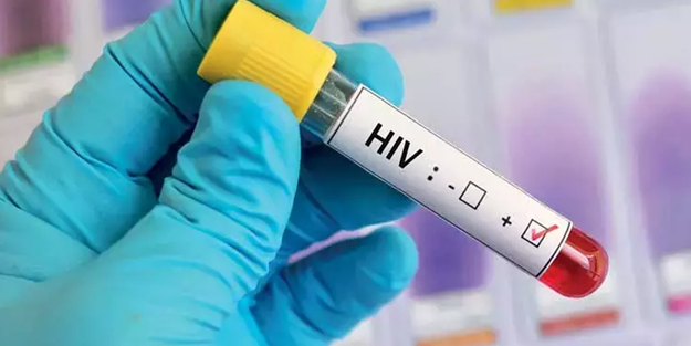 Türkiye'de korkutan AIDS artışı: 10 yılda 4 kat!