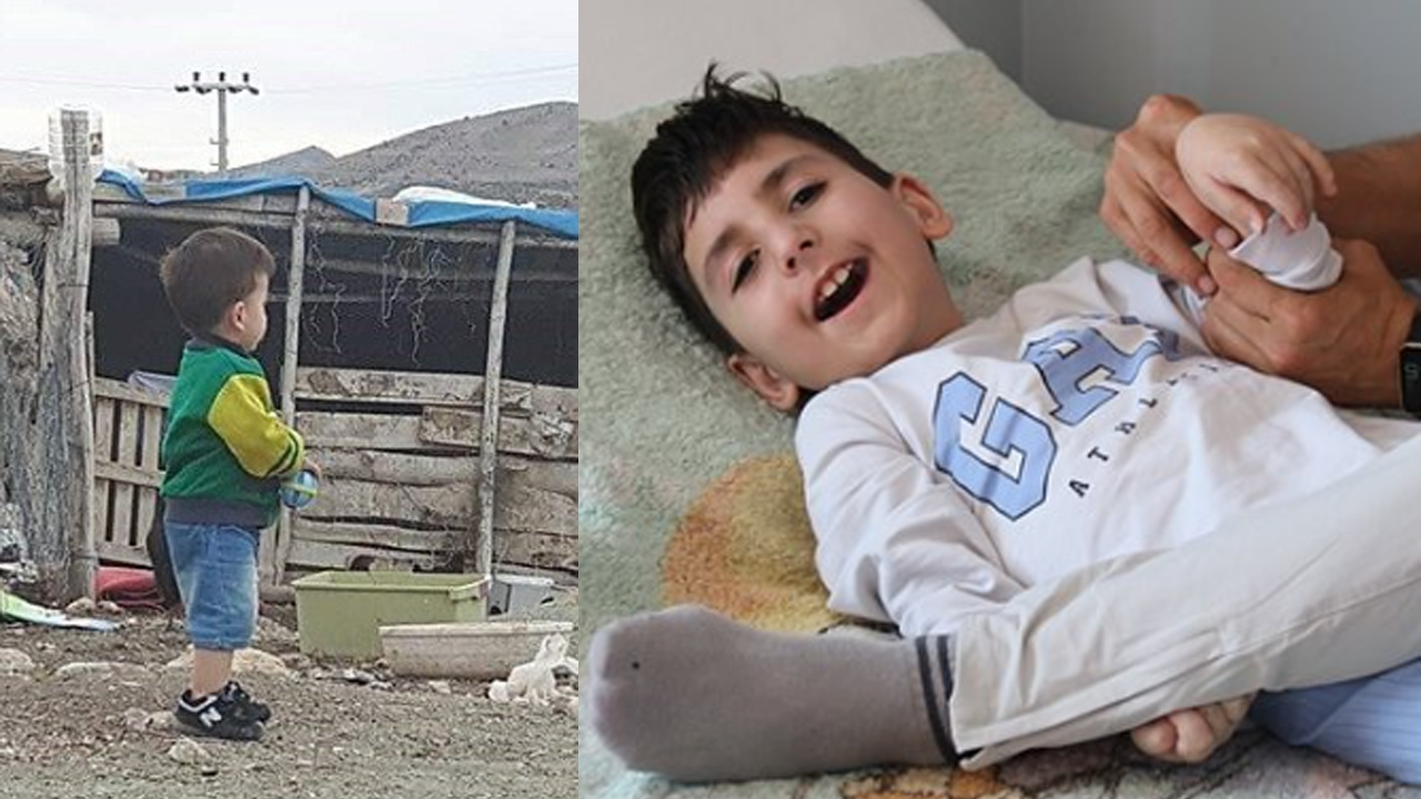 Türkiye'de sinek ısırığı bebeğin hayatını kararttı!