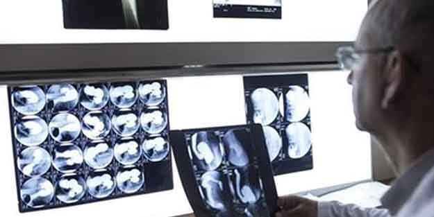 Türkiye'den kanser tedavisi için tarihi buluş! 200 dolara mal oldu