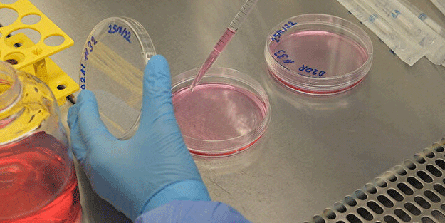 Türkiye'den kanserle ilgili 'devrimsel' buluş