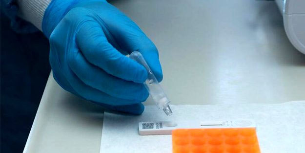 Türkiye'den koronavirüs hamlesi! 15 dakikada sonuç veriyor