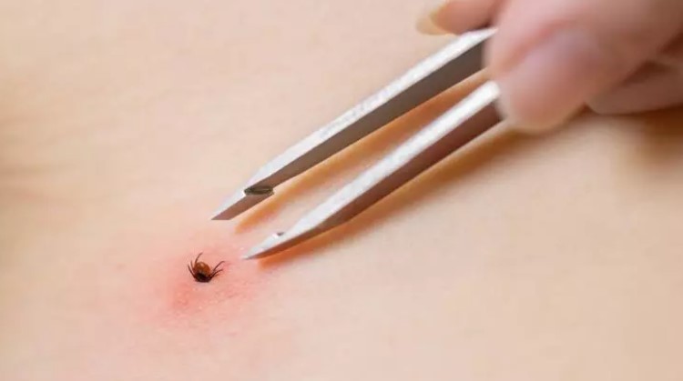 Türkiye'nin her yerinden ölüm haberleri geliyor! İşte keneden korunma yolları