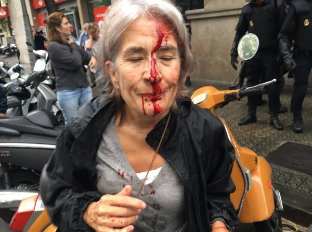 Türkiye'yi kınamak için yarışa girenlerin portresi! ABD ve Avrupa polisinden orantısız güç
