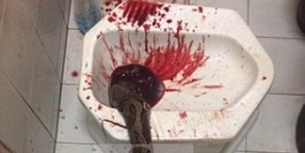 Tuvalette pitonun saldırısına uğradı