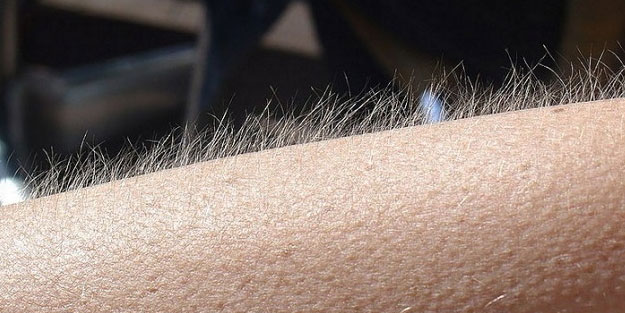 Tüylerin 'diken diken' olmasının sebebi bilimsel olarak açıklandı