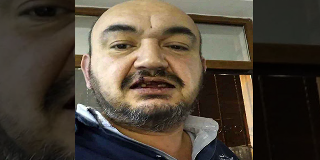 UBER sürücüsüne 10 kişi pusu kurdu...