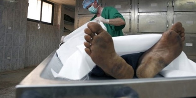 Üç doktorun 'öldü' dediği hasta uyandı