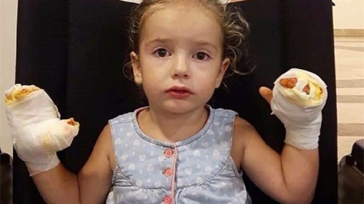Uçan balon elinde patladı