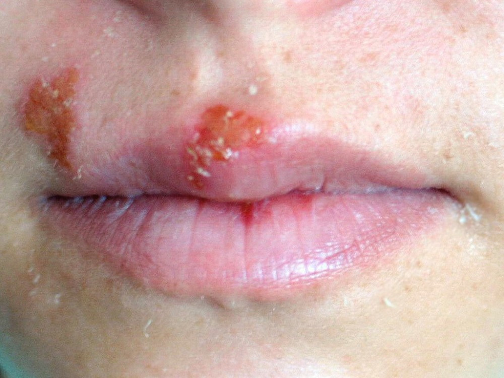 Uçuğa el sürmeyin 