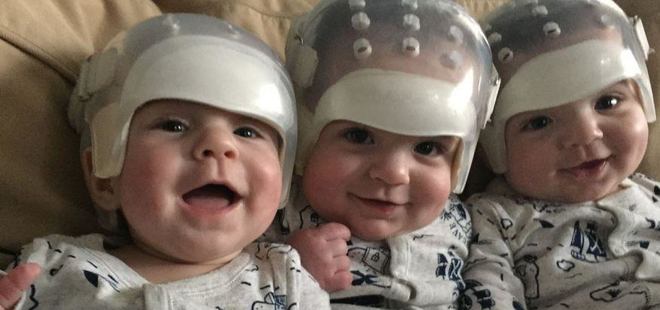 Çok nadir görülen bir hastalıkla doğdular