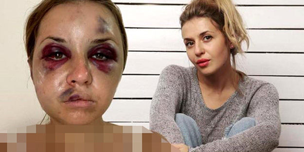 Ukraynalı ünlü sunucuya trende hem tecavüz hem şiddet girişimi!