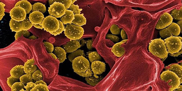 Ülkede salgın alarmı! 5 kişi hayatını kaybetti