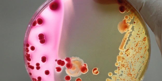 NASA bakteri keşfetti: Dünya'da benzeri görülmemiş türlere dönüştüğü ortaya çıktı