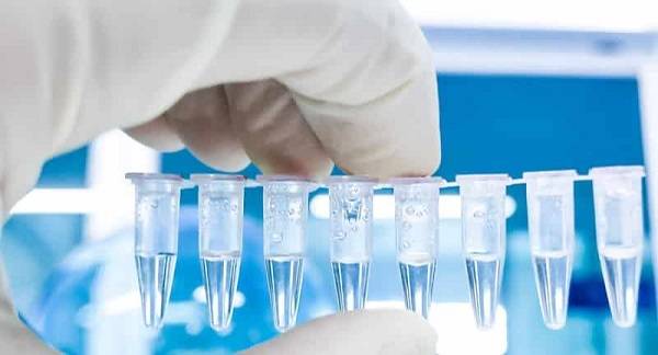 Üniversite öğrencilerine PCR zorunlu mu? Üniversite çalışanları PCR testi yaptırmak zorunda mı?
